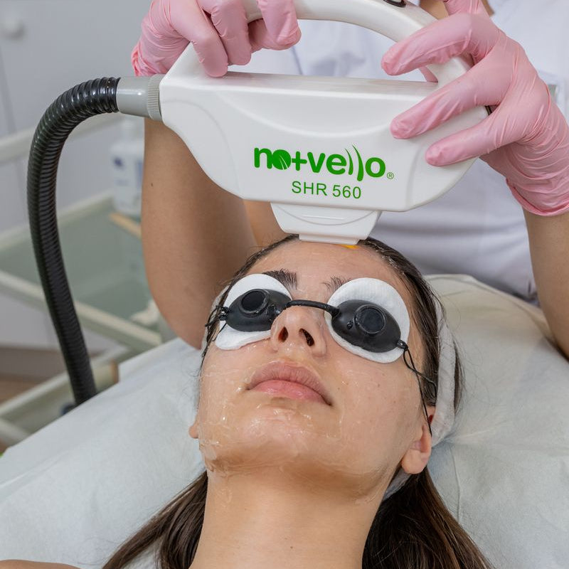 rejuvenare IPL pentru ten luminos si uniform, tatament facial Nomasvello Bucuresti