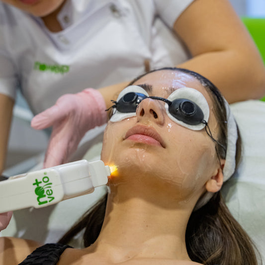 Rejuvenare IPL