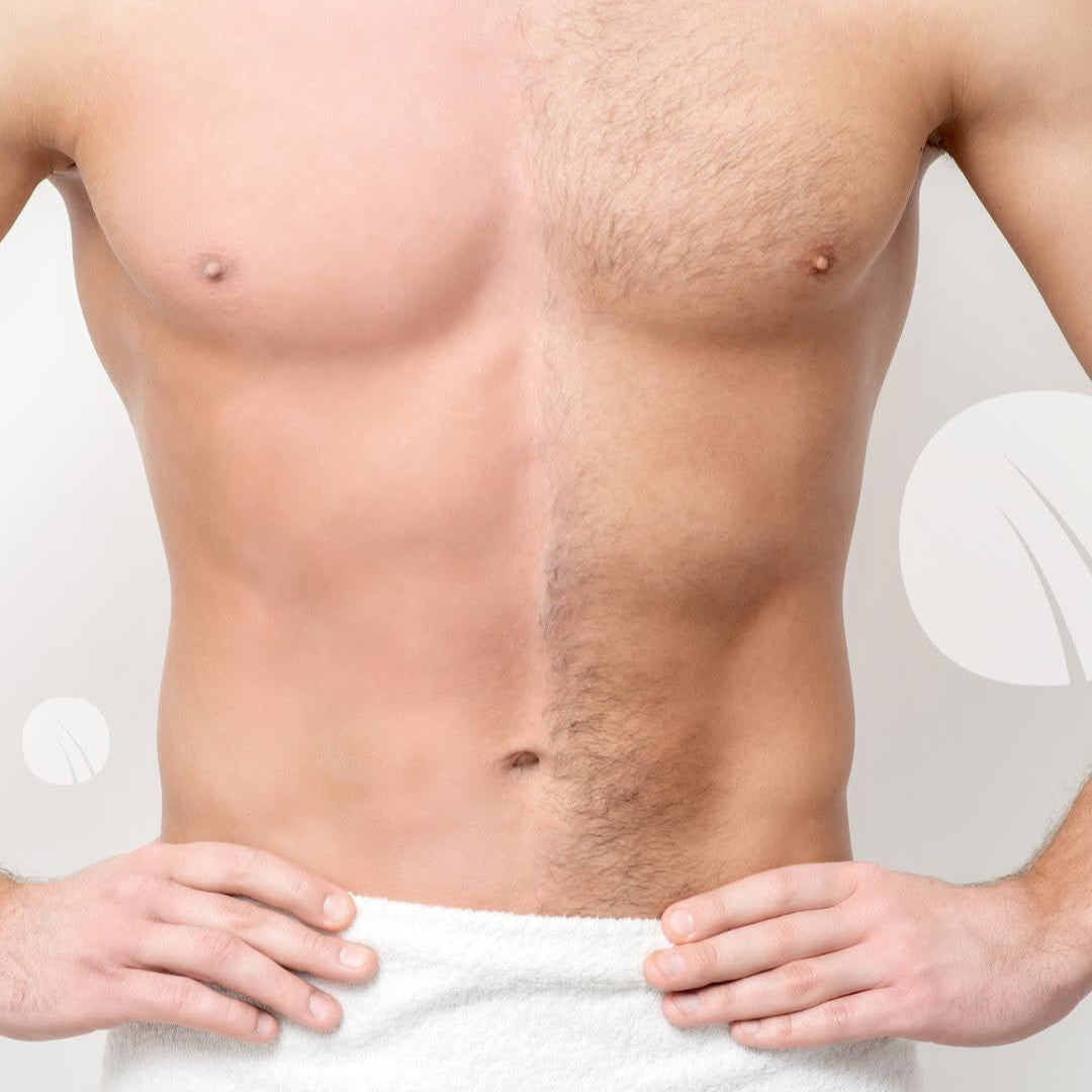 NO+VELLO SEXY – Abonament Epilare