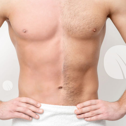 NO+VELLO SEXY – Abonament Epilare