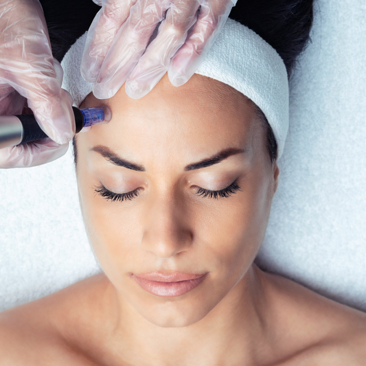 Microneedling Messopen Clasic