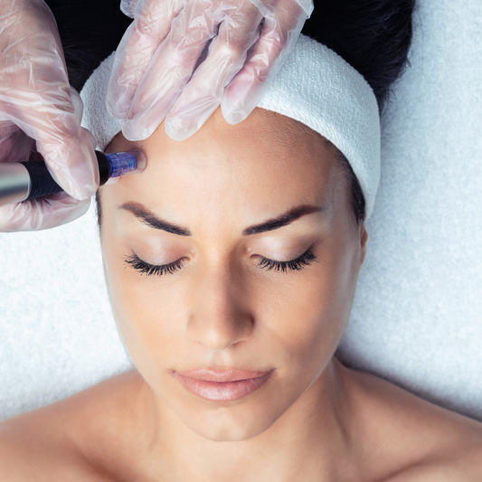Microneedling Messopen Advance