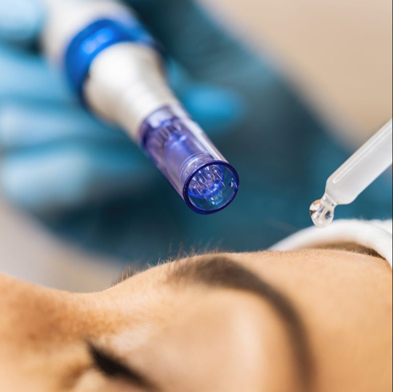 Microneedling MessoPen Clasic cu fiola BCN inclusa – regenerare si uniformizare ten la Nomasvello Mega Mall Point Bucuresti